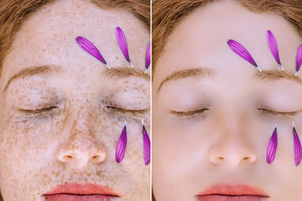 get rid of freckles in photoshop