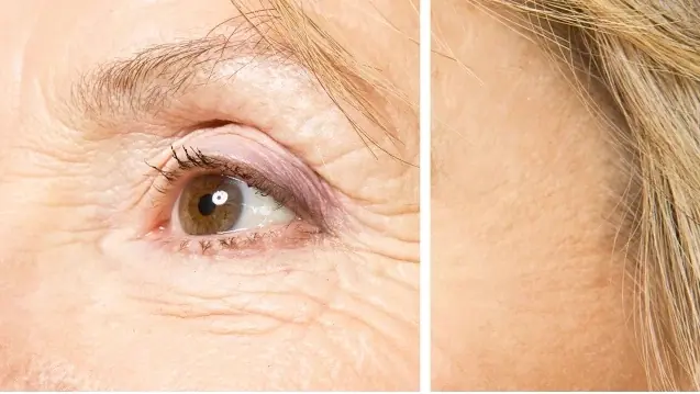 photo wrinkle remover - Photoshop