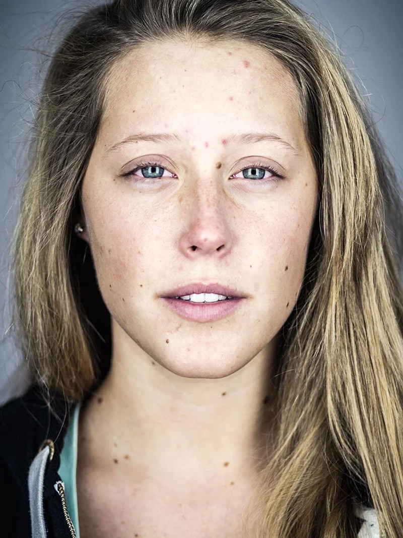 Skin smoothening before image, Skin retouching software, portrait photo editing software