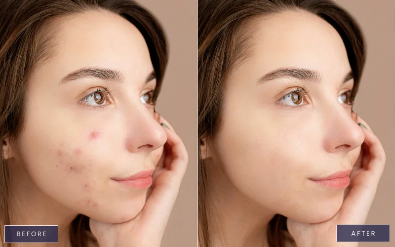 high end skin retouching, how to retouch black skin in photoshop, Skin retouching tutorial