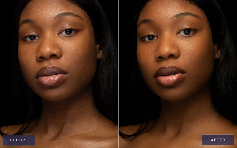 professional skin retouching in photoshop, photoshop face retouching